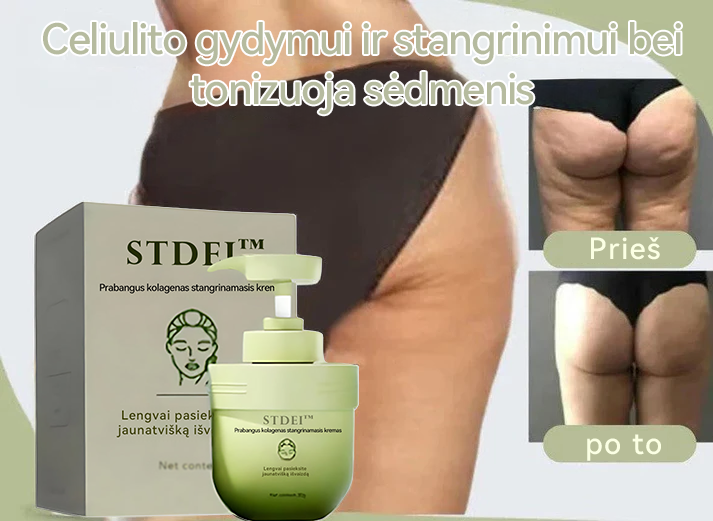 STDEI™ 💖Prabangi kolageno stangrinamoji kremas (atkuria jauno veido odą)✨