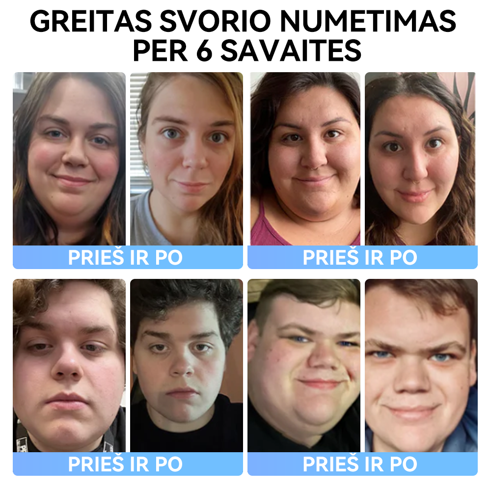 (✅Oficiali parduotuvė) 𝑺𝐩𝐳𝐯® 𝐌𝐞𝐠𝐥𝐮𝐭𝐢𝐝 geriamasis skystis💧 (Maistinio lygio riebalų deginimo produktas, sukurtas Vilniaus universiteto Medicinos fakultete)