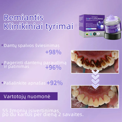 [✅Oficiali parduotuvė] 𝐅𝐀𝐓𝐎𝐍𝐆® Dantų atkūrimo mineralinė milteliai🎉 (LOD rekomenduojama)（🎁 Išskirtinė akcija - nepraleiskite!）