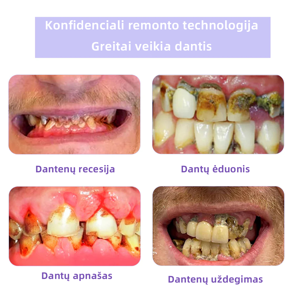 [✅Oficiali parduotuvė] 𝐅𝐀𝐓𝐎𝐍𝐆® Dantų atkūrimo mineralinė milteliai🎉 (LOD rekomenduojama)（🎁 Išskirtinė akcija - nepraleiskite!）
