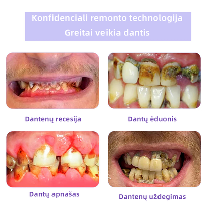 [✅Oficiali parduotuvė] 𝐅𝐀𝐓𝐎𝐍𝐆® Dantų atkūrimo mineralinė milteliai🎉 (LOD rekomenduojama)（🎁 Išskirtinė akcija - nepraleiskite!）