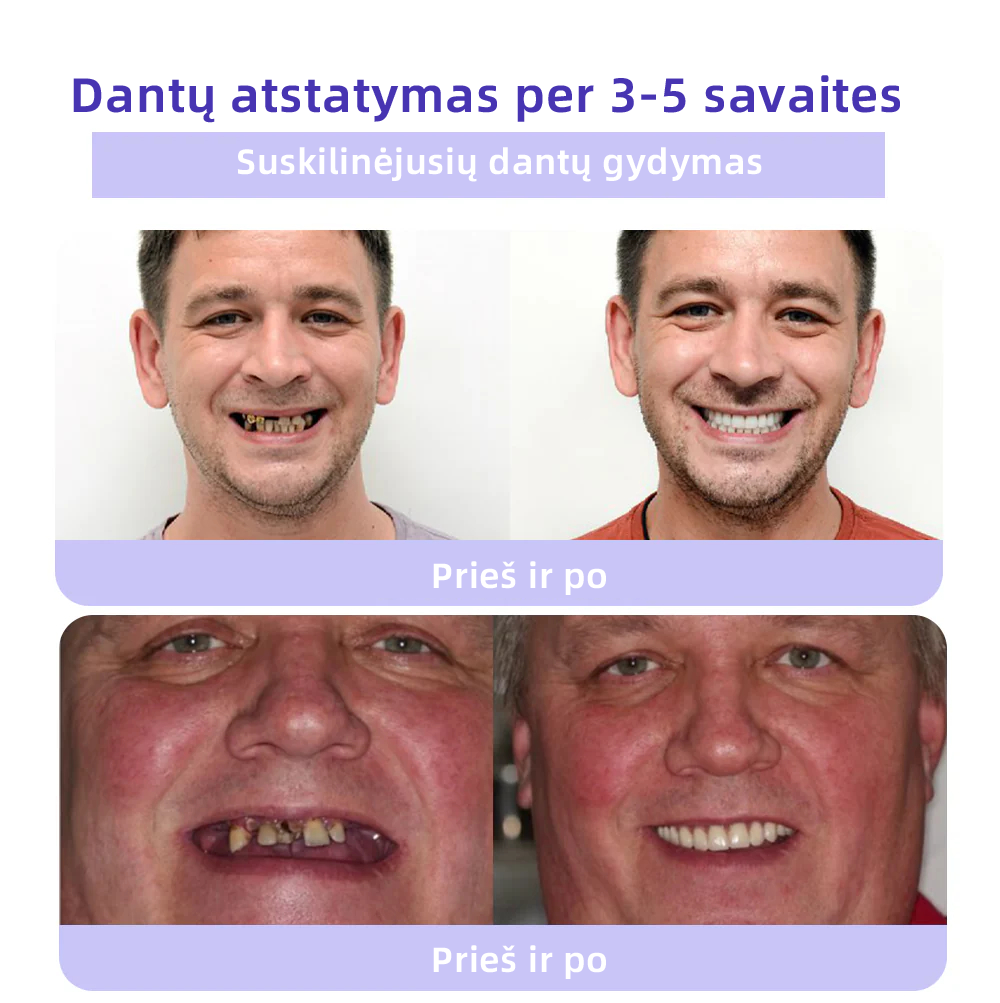 [✅Oficiali parduotuvė] 𝐅𝐀𝐓𝐎𝐍𝐆® Dantų atkūrimo mineralinė milteliai🎉 (LOD rekomenduojama)（🎁 Išskirtinė akcija - nepraleiskite!）
