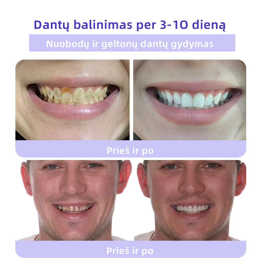 [✅Oficiali parduotuvė] 𝐅𝐀𝐓𝐎𝐍𝐆® Dantų atkūrimo mineralinė milteliai🎉 (LOD rekomenduojama)（🎁 Išskirtinė akcija - nepraleiskite!）
