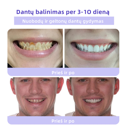 [✅Oficiali parduotuvė] 𝐅𝐀𝐓𝐎𝐍𝐆® Dantų atkūrimo mineralinė milteliai🎉 (LOD rekomenduojama)（🎁 Išskirtinė akcija - nepraleiskite!）