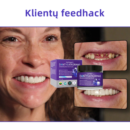 [✅Oficiali parduotuvė] 𝐅𝐀𝐓𝐎𝐍𝐆® Dantų atkūrimo mineralinė milteliai🎉 (LOD rekomenduojama)（🎁 Išskirtinė akcija - nepraleiskite!）