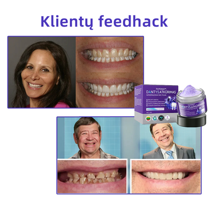 [✅Oficiali parduotuvė] 𝐅𝐀𝐓𝐎𝐍𝐆® Dantų atkūrimo mineralinė milteliai🎉 (LOD rekomenduojama)（🎁 Išskirtinė akcija - nepraleiskite!）