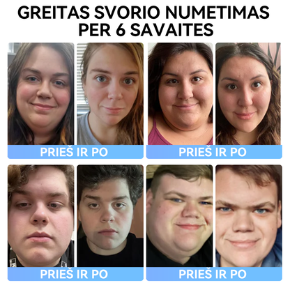(✅Oficiali parduotuvė) 𝑺𝐩𝐳𝐯® 𝐌𝐞𝐠𝐥𝐮𝐭𝐢𝐝 geriamasis skystis👩‍⚕️ (Maistinio lygio riebalų deginimo produktas, sukurtas Vilniaus universiteto Medicinos fakultete)